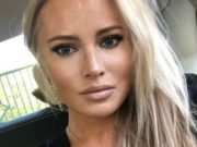 Дана Борисова откровенно рассказала фанатам о четвертой подтяжке лица