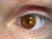 В Британии разработали технологию 3D-печати невероятно реалистичных глазных протезов