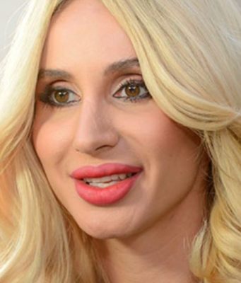 Светлана Лобода попала в больницу