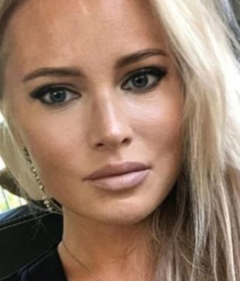 Дана Борисова откровенно рассказала фанатам о четвертой подтяжке лица