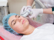 Все о процедуре smas-лифтинга