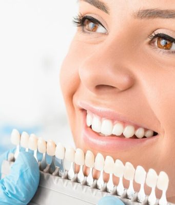Современные методы отбеливания зубов
