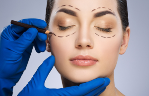 Пластика век: виды и методика