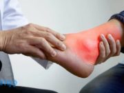 Психодерматология: понятие, особенности