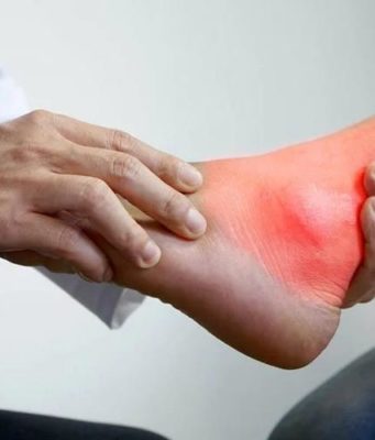 Психодерматология: понятие, особенности