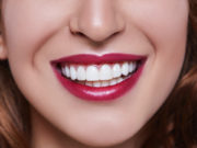 Профессиональная чистка зубов: как проходит процедура?