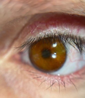 В Британии разработали технологию 3D-печати невероятно реалистичных глазных протезов