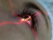 Лазерная коррекция зрения: преимущества процедуры