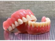 Какое протезирование подойдет при отсутствии зубов