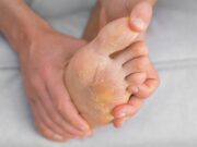 Крем от грибка стопы: эффективное решение проблемы