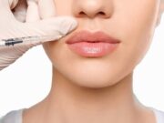 Контурная пластика губ: красота, объём и естественность