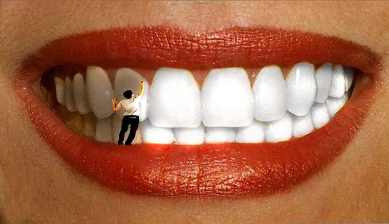 Какими народными средствами можно быстро отбелить зубы